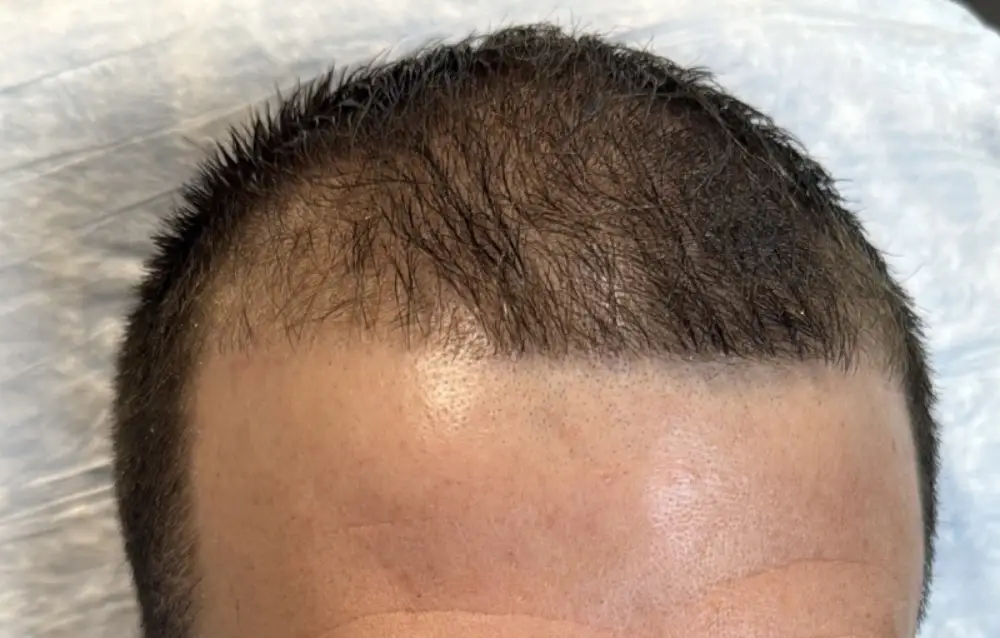 After