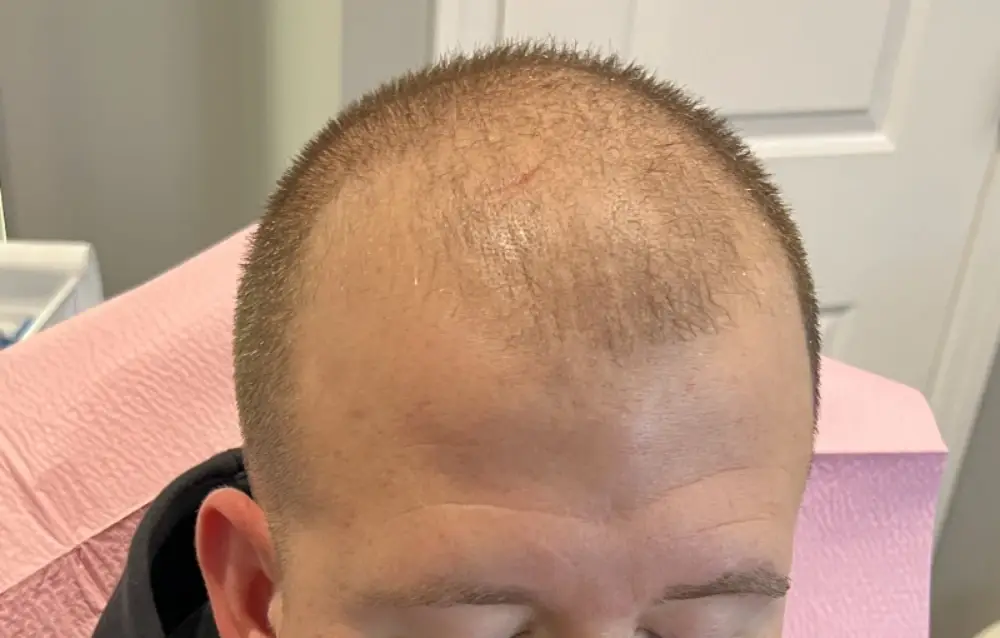 Before